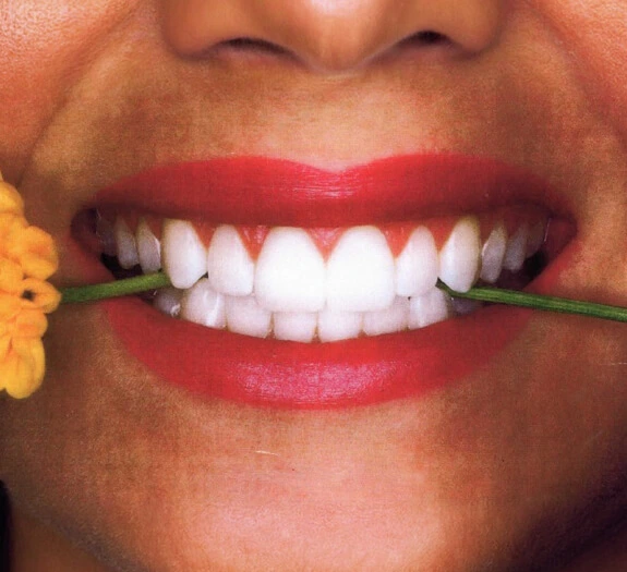 CEREC